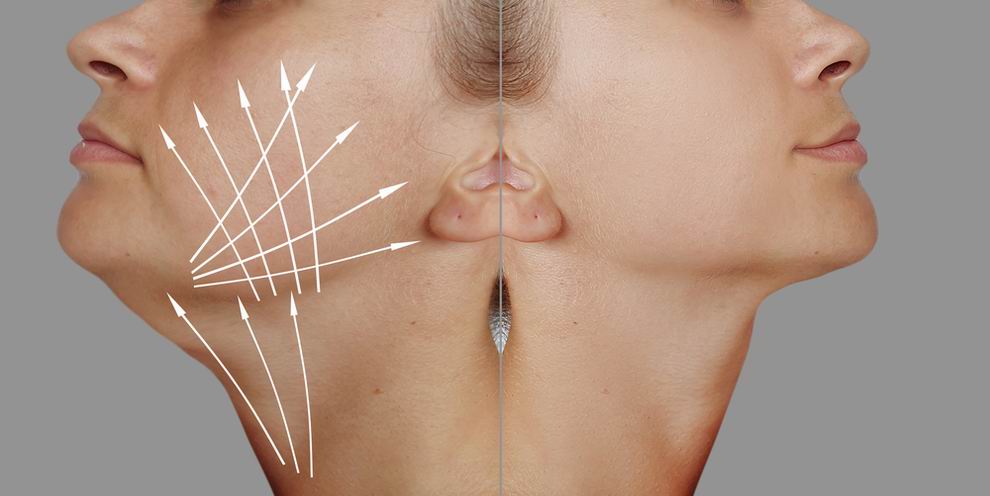 injekciós zsírbontás