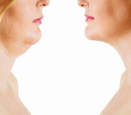 toka kezelés zsírbontás