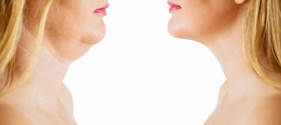 toka kezelés zsírbontás